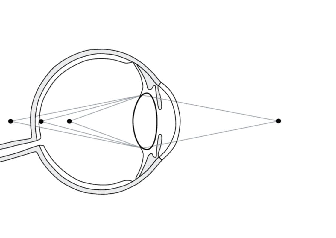 Illustration des menschlichen Auges, das Lichtstrahlen auf die Retina fokussiert.