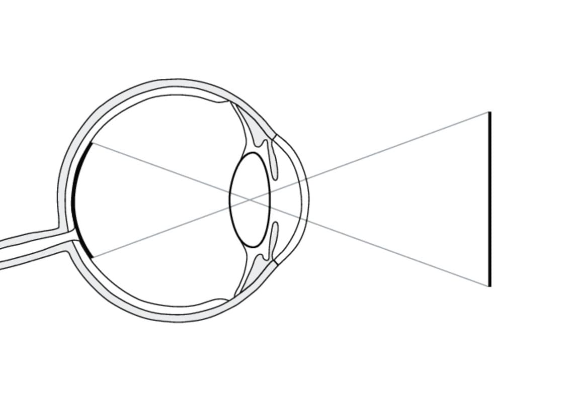 Schema des menschlichen Auges, das die Lichtbrechung und Bildprojektion auf der Retina zeigt.